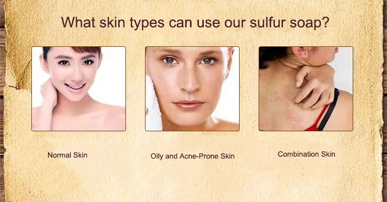 What skin types can use our sulfur soap？