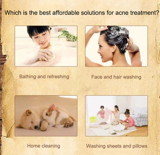 Which is the best affordable solutions for acne treatment? | the Nice bazaar